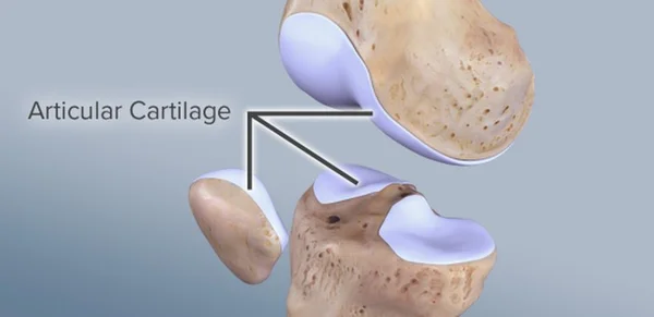 Illustration anatomique d'une articulation de genou mettant en évidence le cartilage articulaire.